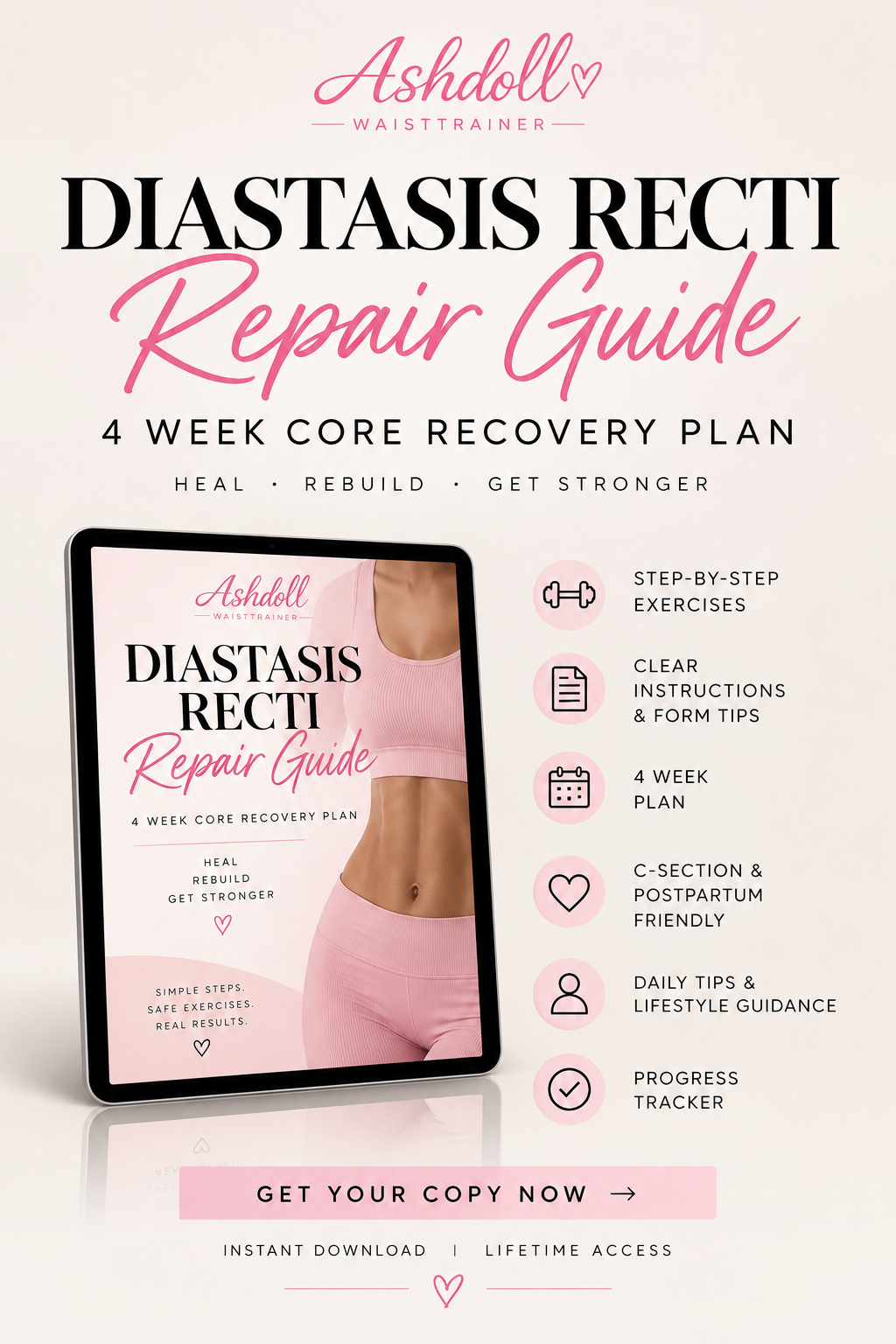 Diastasis Recti Repair Guide